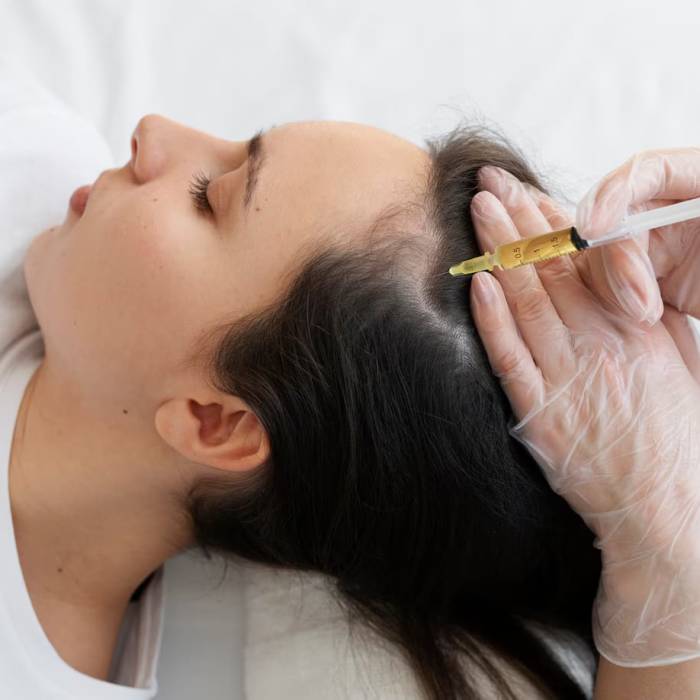woman-getting-scalp-prp-treatment-high-angle_23-2149404693 woman-getting-scalp-prp-treatment-high-angle_23-2149404693